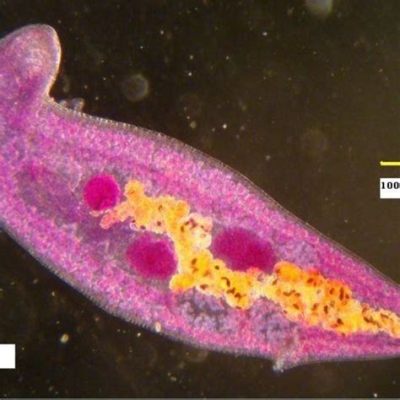  Plagiorchis Muris: Un Ver Parasite Qui Fait des Bonds dans le Monde des Mammifères!